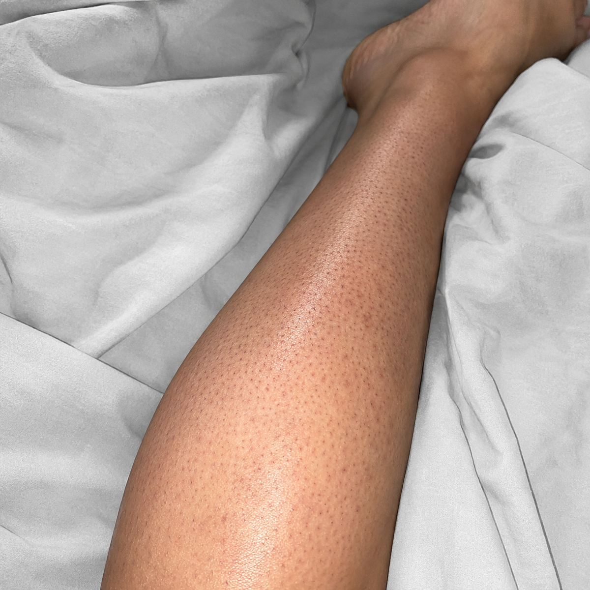 Skin before using KINU